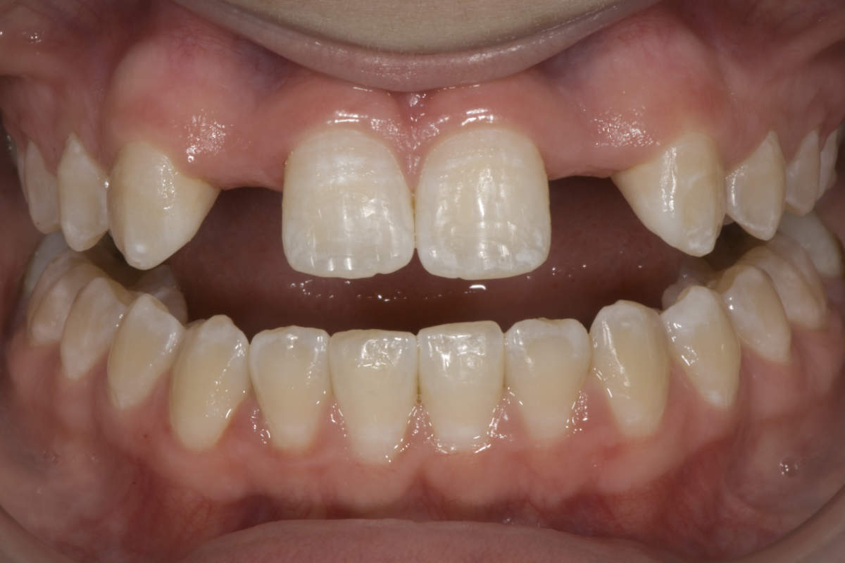 Before dental treatment.
